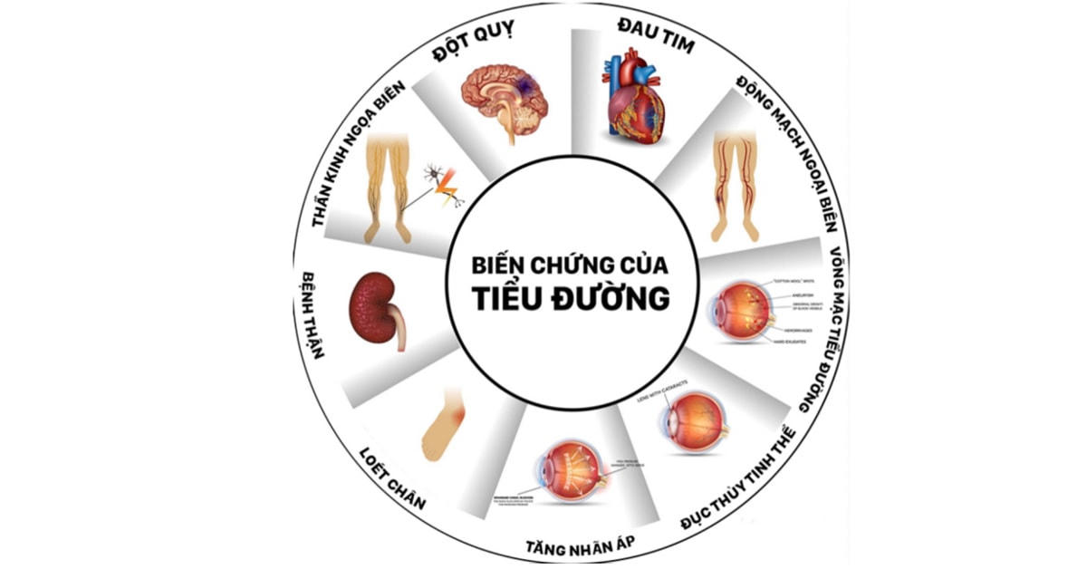 Đái tháo đường không phải là ‘bệnh nhà giàu’