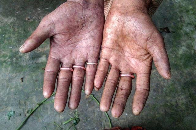 Gia đình độc nhất vô nhị trên Trái đất không có… dấu vân tay