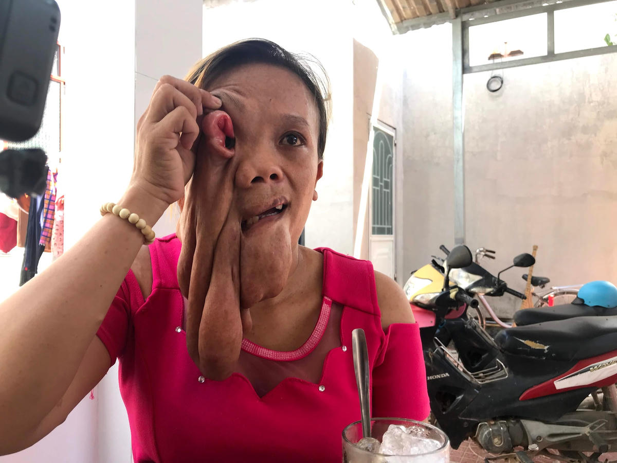 Chị Út Hương có khuôn mặt thật đau khổ.