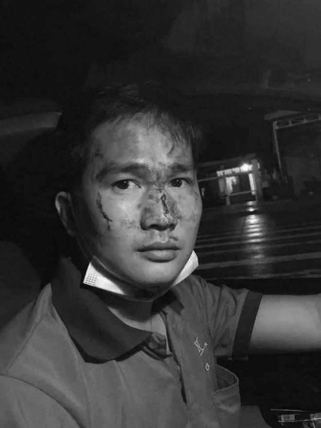 Tài xế taxi bị đánh đổ máu.