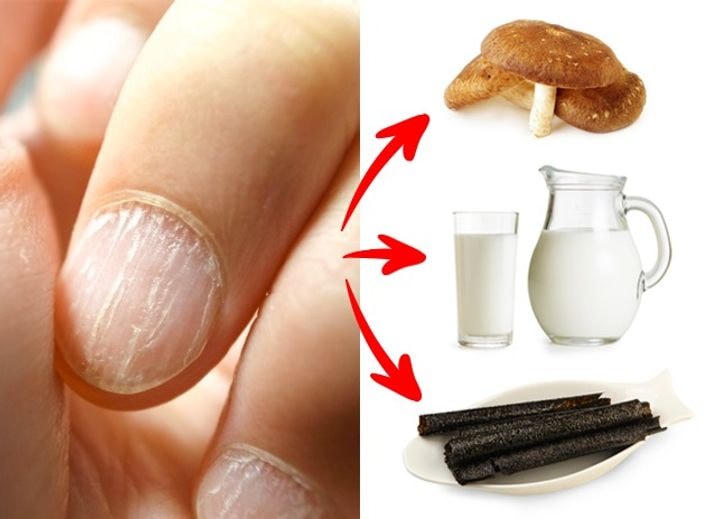 8 dấu hiệu cho thấy cơ thể bạn đang kêu cứu