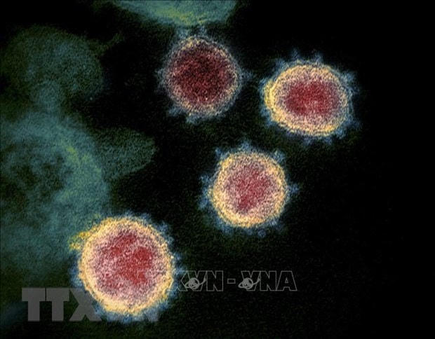 Virus SARS-CoV-2 gây bệnh Covid-19 soi trên kính hiển vi (Ảnh: AFP/TTXVN).