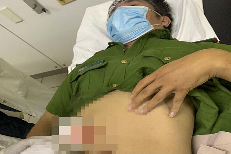 Đại uý Nguyễn Thành Chung bị đâm trọng thương. Ảnh: Công an cung cấp.