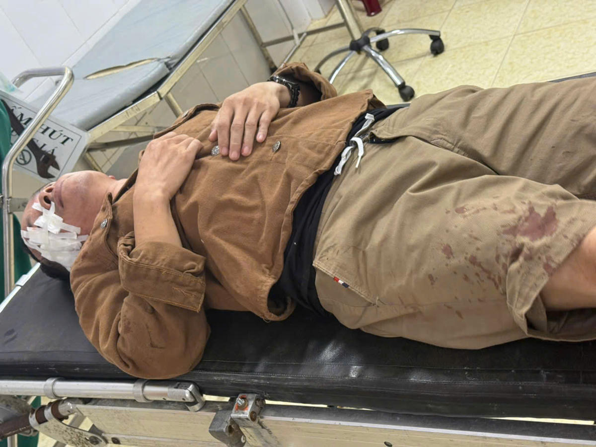 Và nhiều người khác bị thương. Ảnh: CTV.