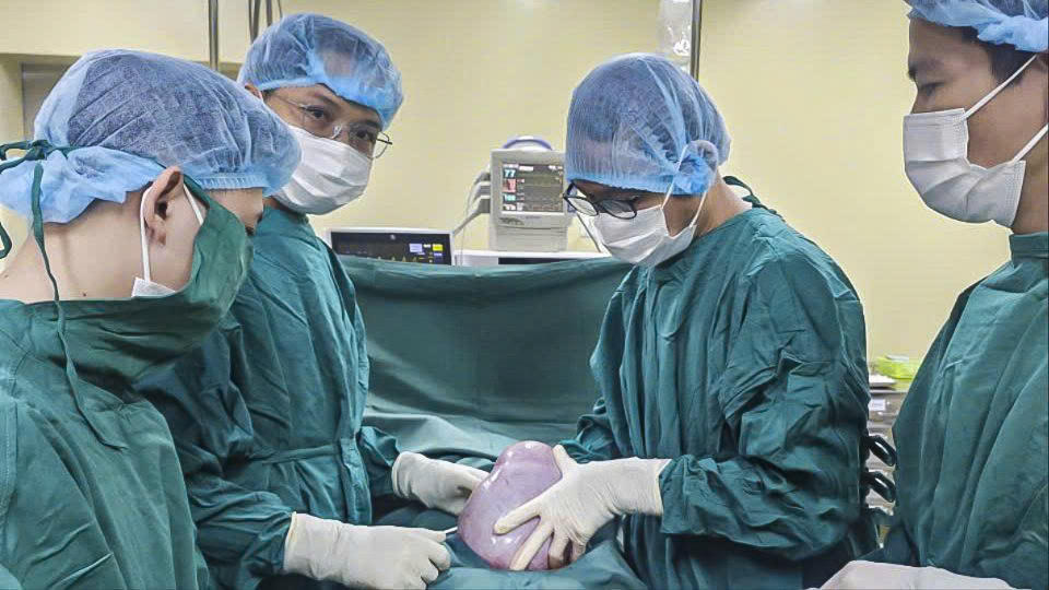 Các y bác sĩ đang phẫu thuật lấy khối u nặng 5,5kg cho bệnh nhân H. Ảnh: CV.