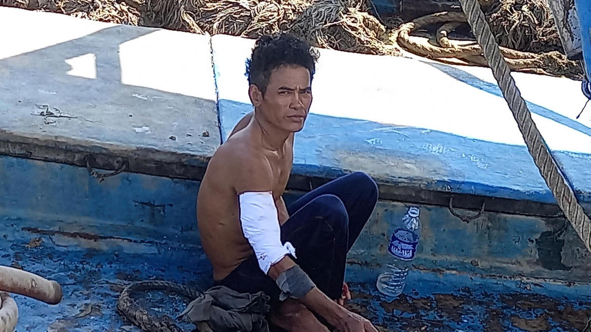 Ngư dân Đào Nhứt Lít sau khi được sơ cấp cứu, băng bó vết thương. Ảnh: Đức Định.