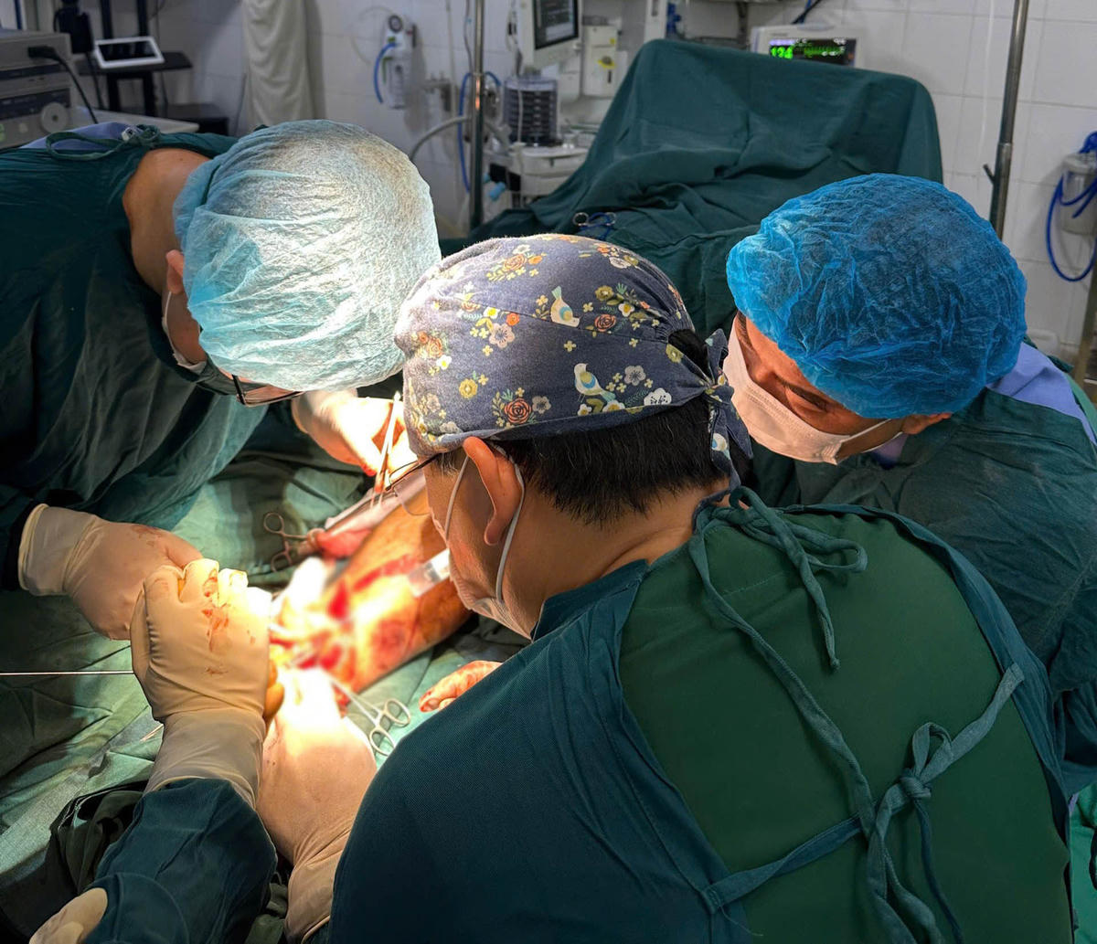 Đây là ca bệnh đứt rời chân thứ 2 được các bác sĩ của Bệnh viện Đa khoa tỉnh Điện Biên nối thành công. Ảnh: CTV. 