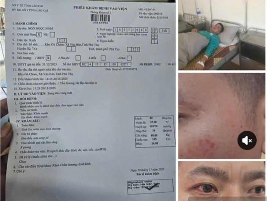 Hình ảnh thương tích được chia sẻ trên&nbsp;tài khoản Facebook tên “Ngô Năm”. Ảnh: IT.