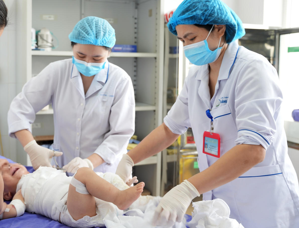 Bỏng nặng ở trẻ em để lại hậu quả lâu dài và ảnh hưởng đến tâm lý trẻ nhỏ.  