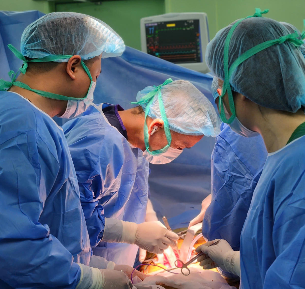 Các bác sĩ tiến hành lấy ghép đa tạng (ảnh BVCC)