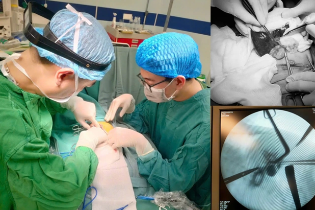 Các bác sĩ phẫu thuật điều trị cho bệnh nhi mắc bệnh hiếm. Ảnh: BV Sản Nhi tỉnh Phú Thọ.