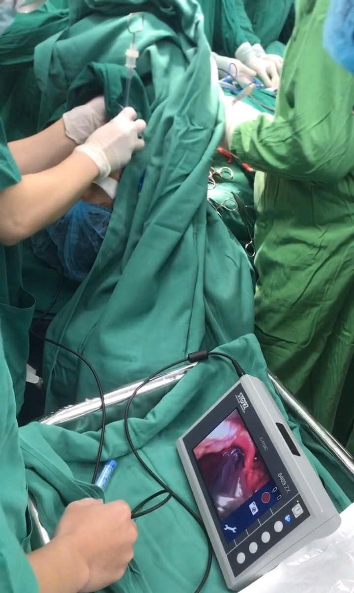 Ca mổ phức tạp, cần có sự hỗ trợ tối đa của hệ thống camera giúp đặt nội khí quản thuận lợi. Ảnh: Bệnh viện C.