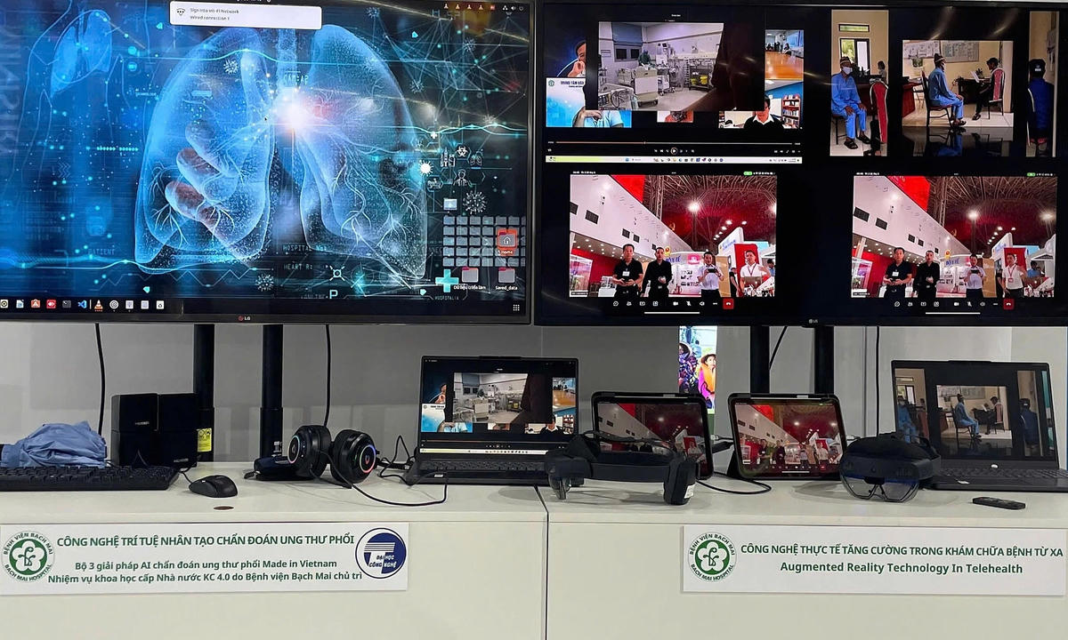 Bệnh viện Bạch Mai ứng dụng AI trong chẩn đoán sớm ung thư phổi. Ảnh: Thế Anh.
