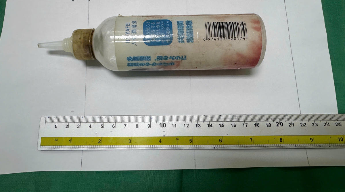 Dị vật chai nhựa được lấy ra khỏi trực tràng nam bệnh nhân 34 tuổi với kích thước lớn. (Ảnh: Trung Ngãi).