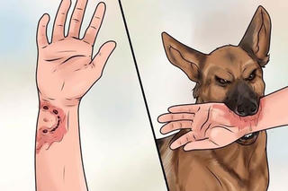 Nhiều trẻ nguy kịch vì bị chó cắn