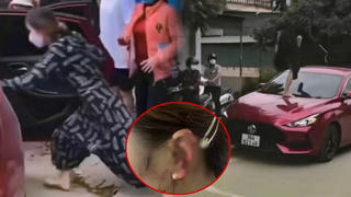 Đi đánh ghen 1 mình, người phụ nữ đạp vỡ kính ô tô, cắn đứt tai một cô gái