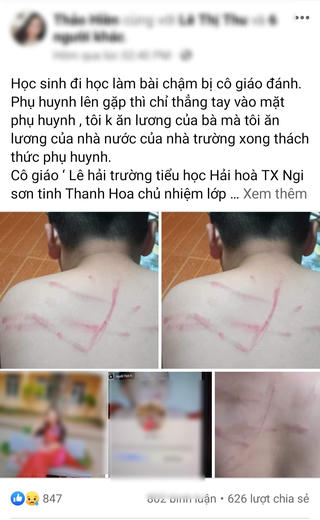 Cô giáo dùng roi tre, đánh bầm tím lưng học sinh vì không làm bài tập
