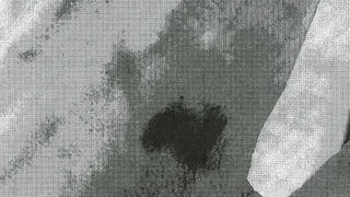 Lộ ảnh chụp thương tích của Angelina Jolie trong vụ xô xát với Brad Pitt trên máy bay