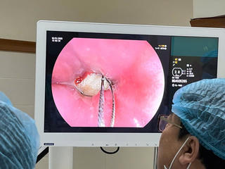 Nam thanh niên nhập viện khi vô tình nuốt xương heo