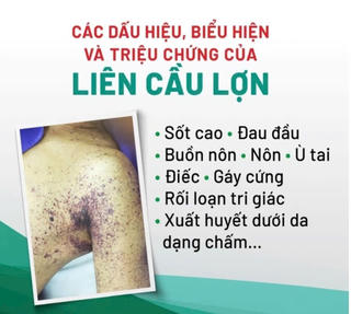 Sốt cao đi khám, người đàn ông được chẩn đoán mắc liên cầu lợn