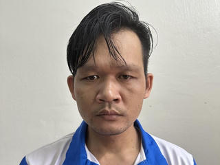 Chồng tạt axit vào mặt vợ khiến nạn nhân có nguy cơ mù lòa