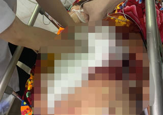 Hải Phòng: Con rể chém bố mẹ vợ và vợ thương vong