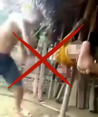 Phú Thọ: Công an vào cuộc vụ cháu bé nghi bị bạo hành