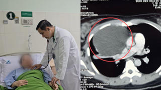 Nội soi lấy khối u “khủng” chèn ép tim phổi người phụ nữ ở miền Tây