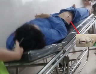 Trên đường đi học, cán bộ Cục Thuế bị đâm trọng thương ﻿