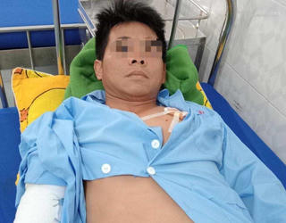 Đắk Lắk: Chó becgie cắn chủ đứt gân tay