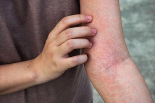 Khôn lường dịch sốt xuất huyết