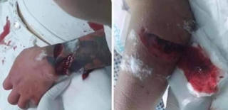 Thái Bình: Chém trọng thương bố, cậu bạn gái trong ‘bữa cơm ra mắt’