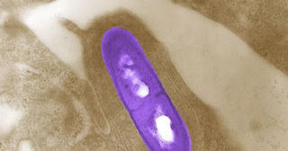 Bùng phát bệnh do nhiễm khuẩn Listeria ở Mỹ, 8 trường hợp đã tử vong