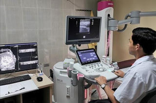 Cân nhắc quyết định tầm soát ung thư