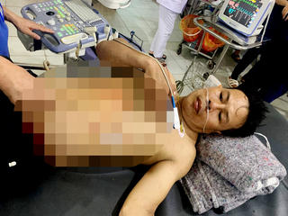 Hà Tĩnh: Người đàn ông dùng dao đâm chết bạn gái ở cùng nhà