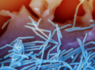 Mỹ phê duyệt vaccine phòng virus hợp bào hô hấp