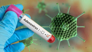Không nên lạm dụng việc xét nghiệm Adenovirus tại nhà