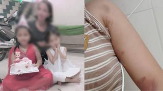 Cụ ông 74 tuổi tố cáo con rể bạo hành con gái đến chết