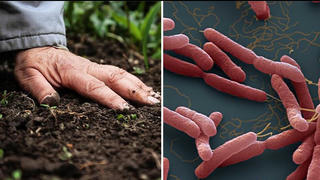 Hiểu đúng về bệnh whitmore