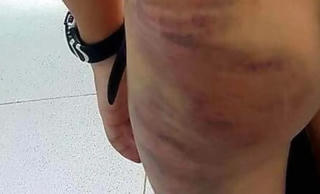 UBND tỉnh Cà Mau chỉ đạo khẩn vụ bé trai lớp 1 bị mẹ kế bạo hành