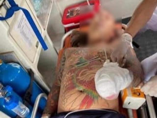 Kinh hoàng nam thanh niên bị chém lìa bàn tay khi đang cắt tóc