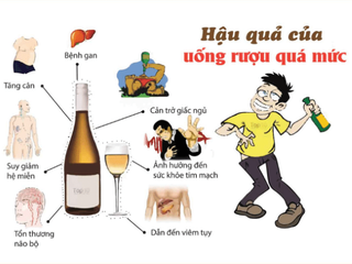 Nghiện rượu - nguyên nhân chính gây viêm tụy mạn