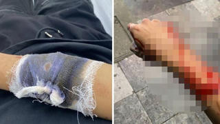 Hà Nội: Truy tìm nhóm đối tượng chém trọng thương, cướp xe của thiếu niên 17 tuổi