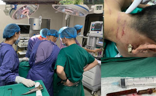 Phú Thọ: Cứu sống nam thanh niên bị thanh tre đâm xuyên cổ