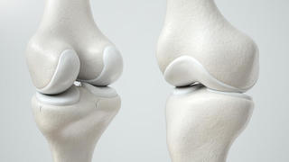 Can thiệp chiều cao khi nào hiệu quả?