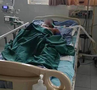 Quảng Nam: Một bệnh nhân tử vong do nhiễm 'vi khuẩn ăn thịt người'