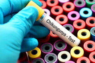 Tăng cường giám sát dịch Chikungunya