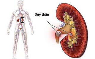 Tổn thương thận do đái tháo đường ngày càng tăng