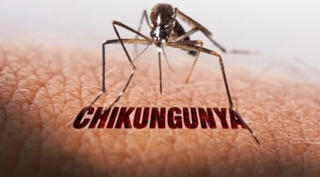 Chikungunya là bệnh gì và khác sốt xuất huyết ra sao?