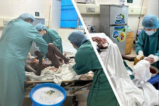 Điều trị thành công bệnh lý hiếm gặp trên thế giới